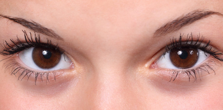 10 ok, amitől karikás lehet a szemed!